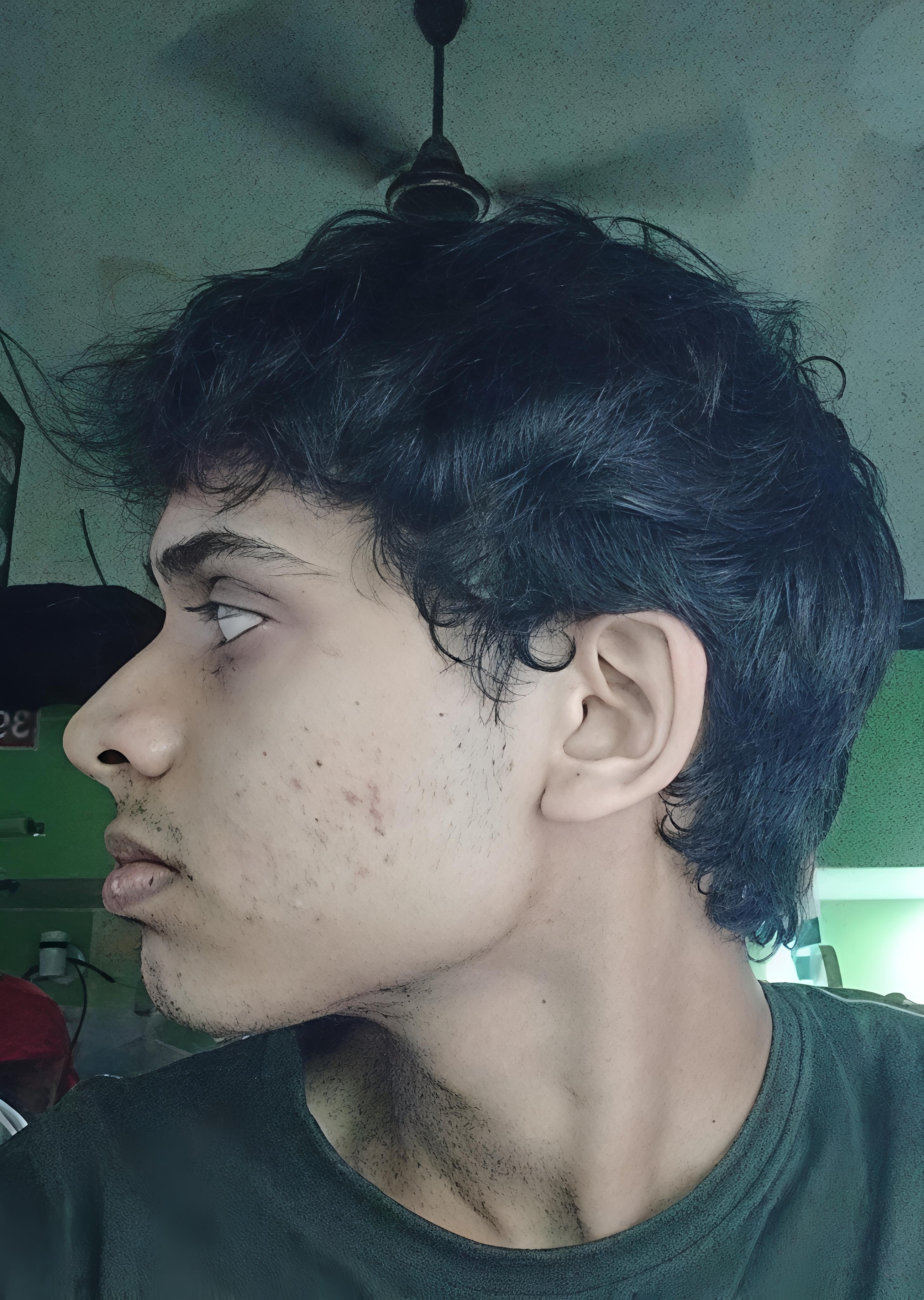 1000050181