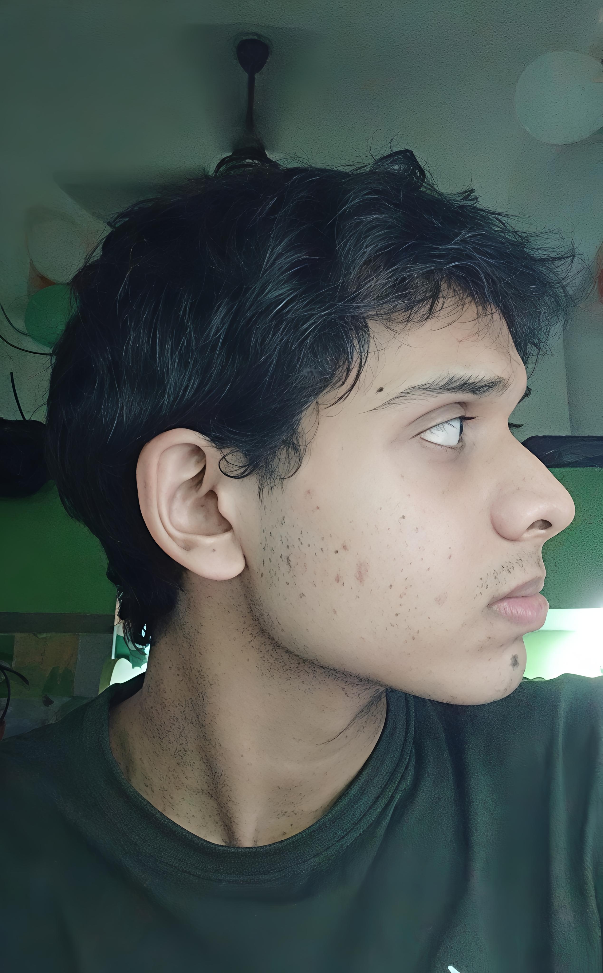 1000050180