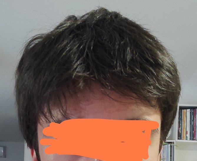 1000043804