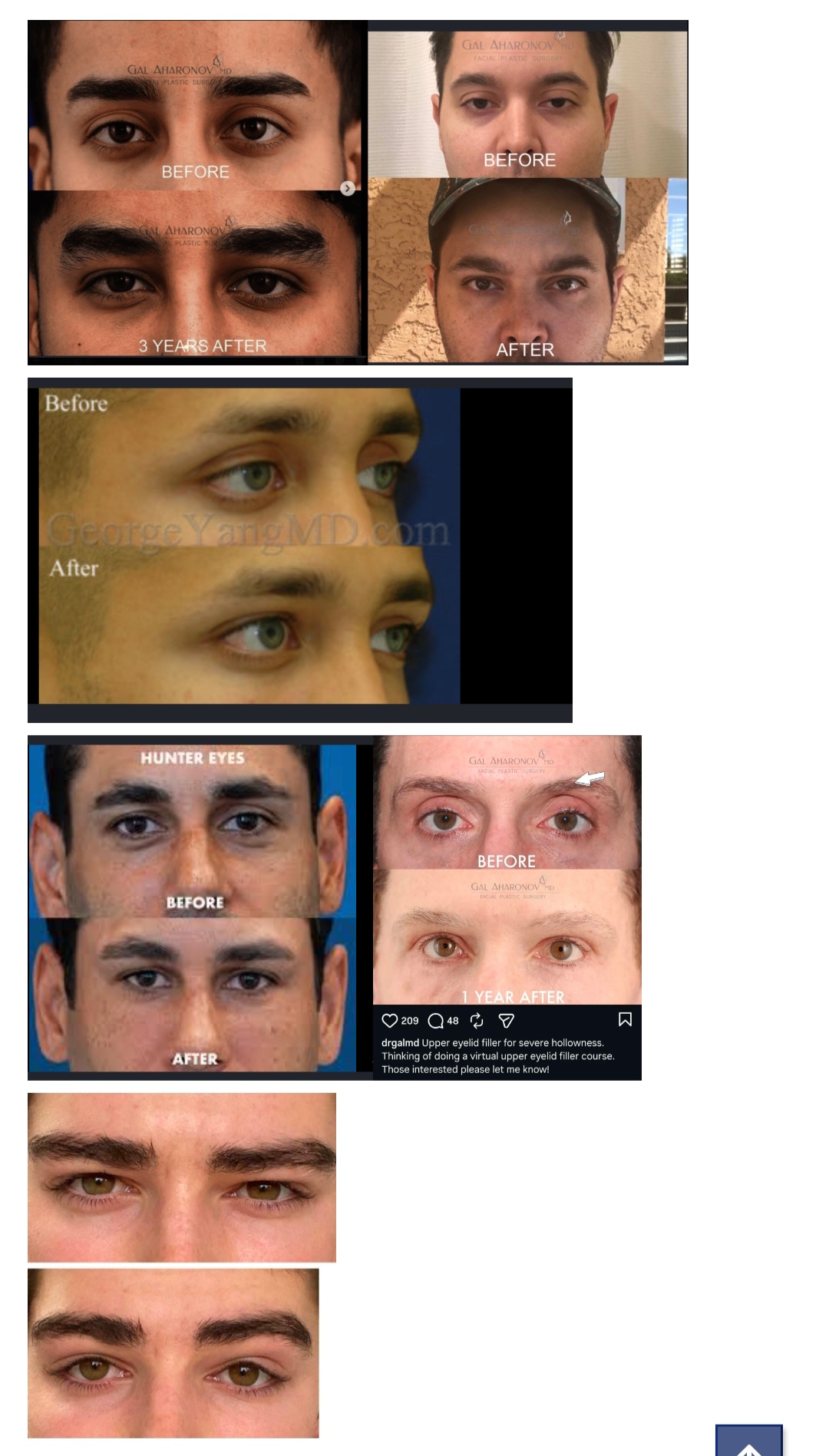 1000135159