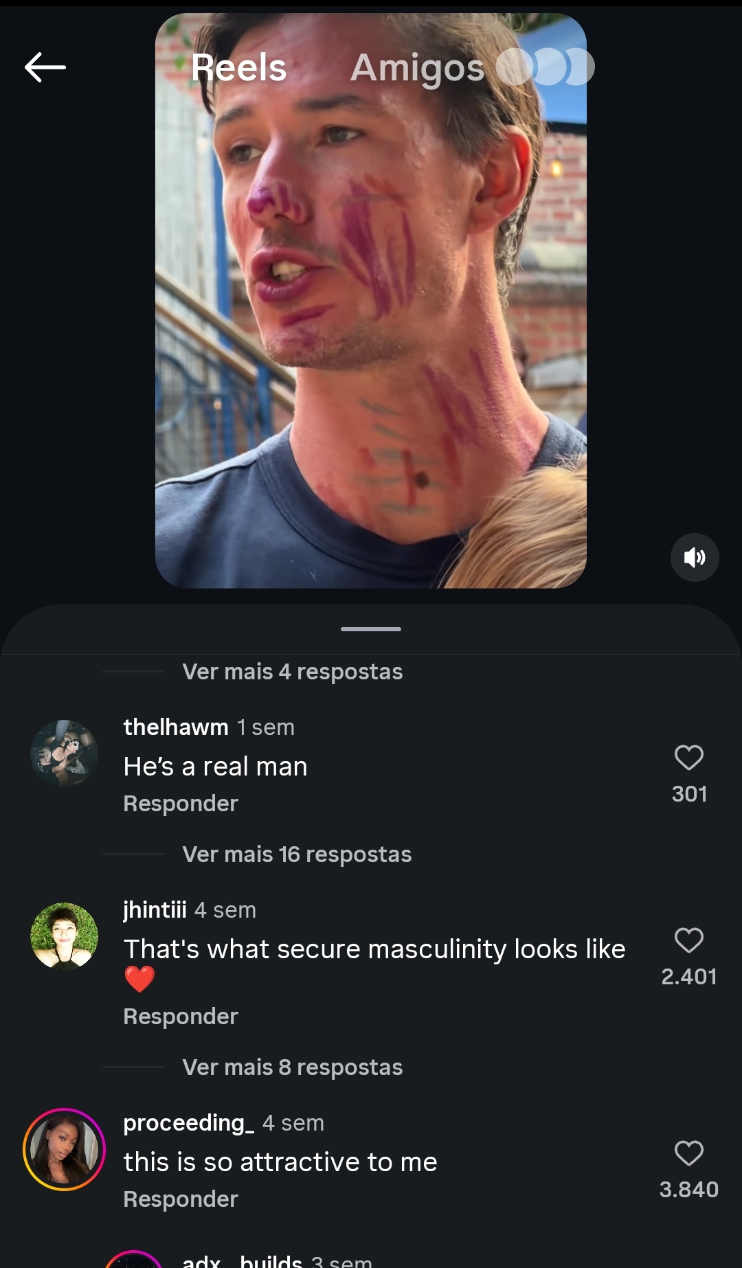 1000007187