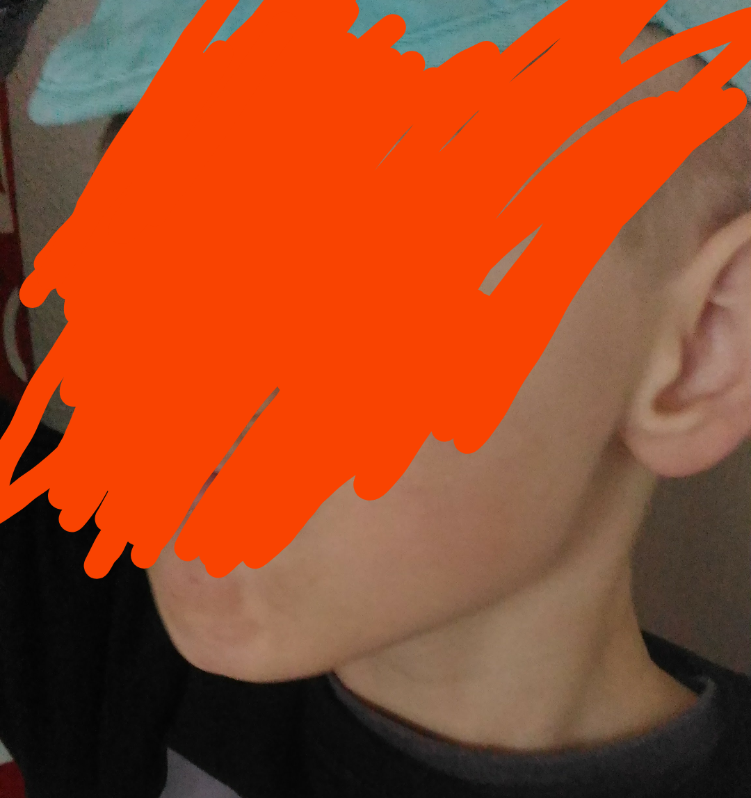 1000015638