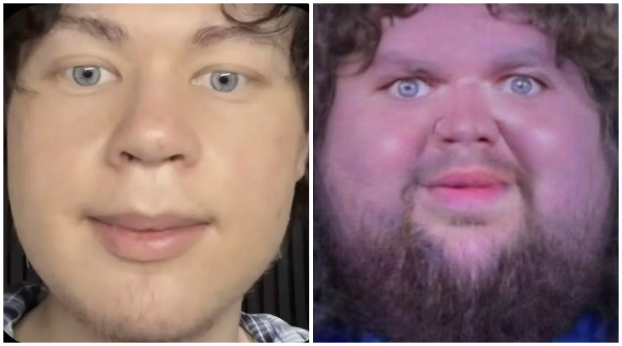 Timvance