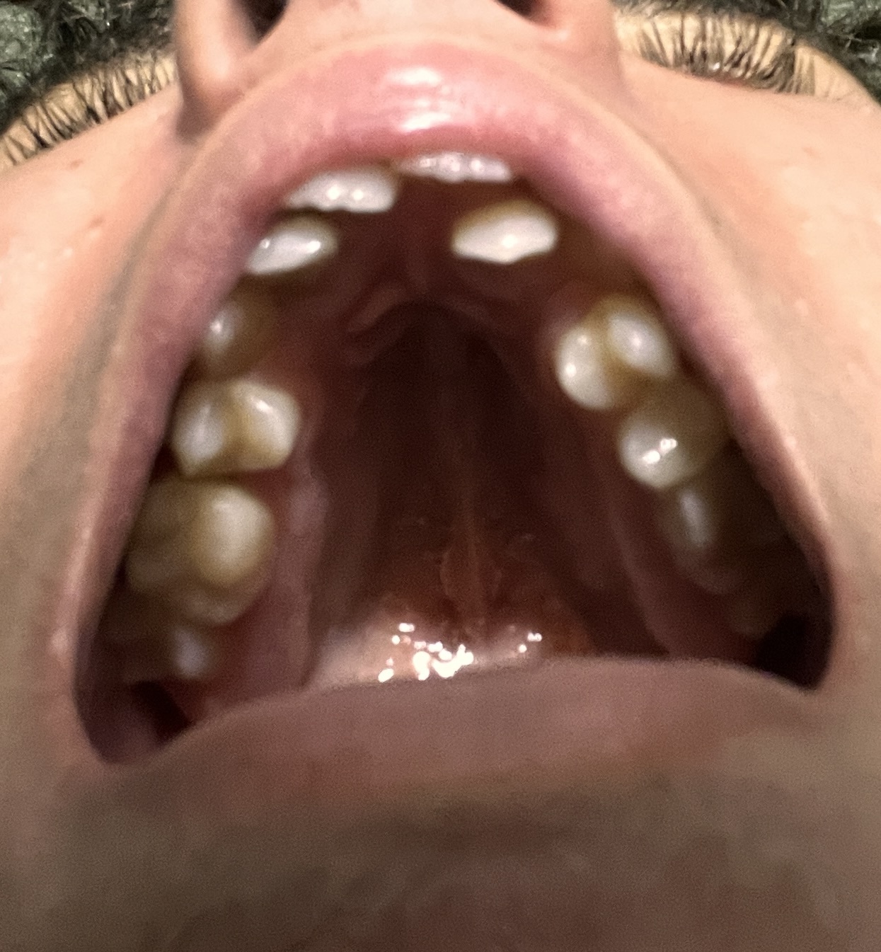 IMG 2019