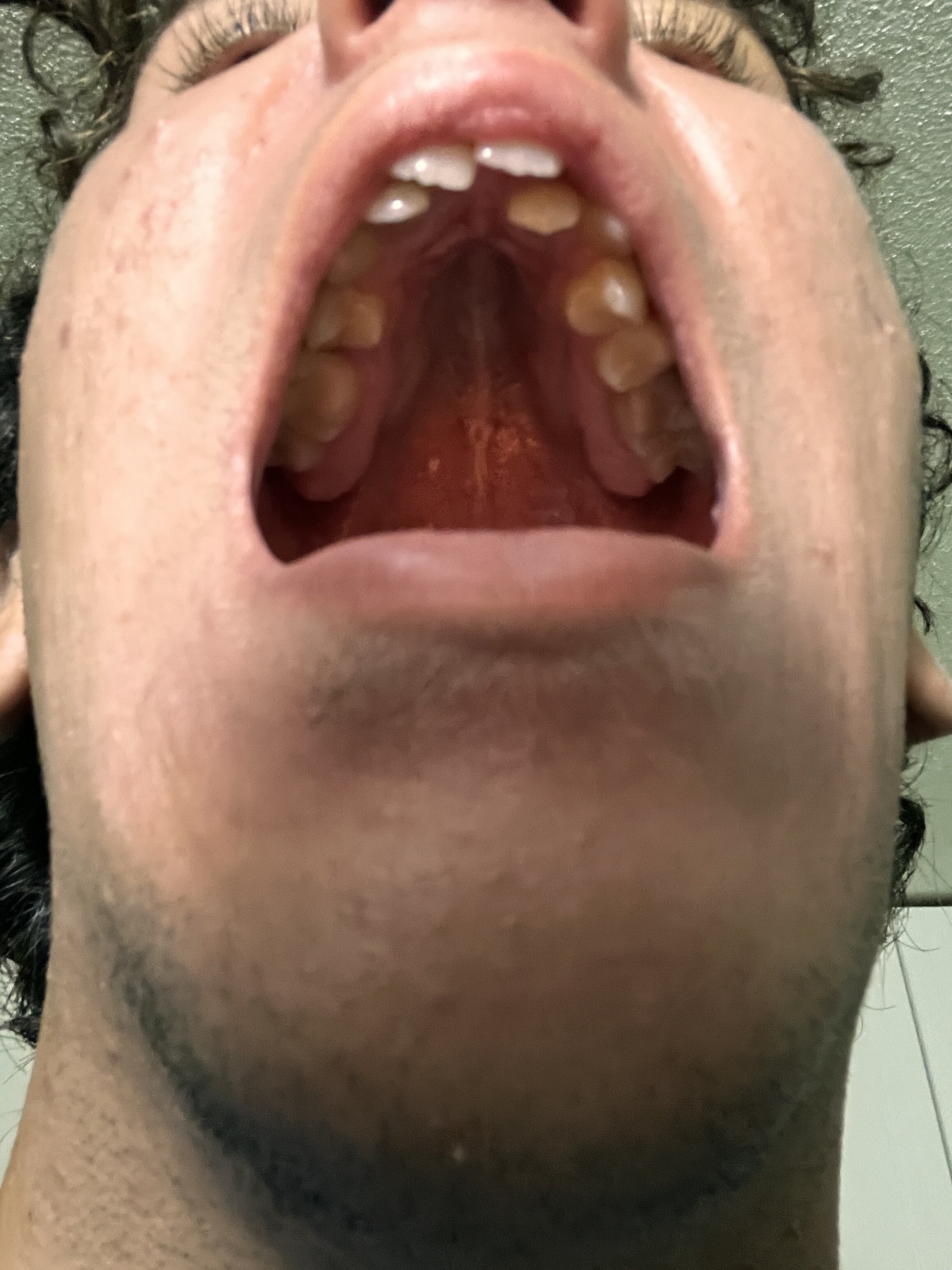 IMG 2017