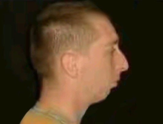 1000135541