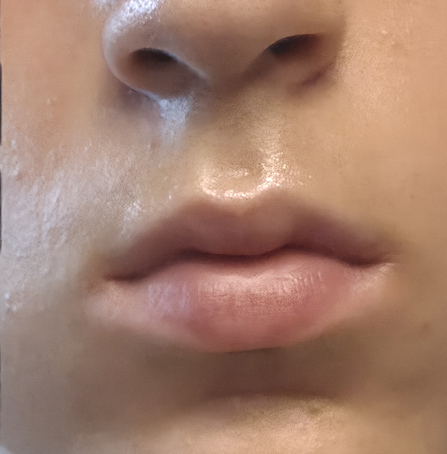 6241