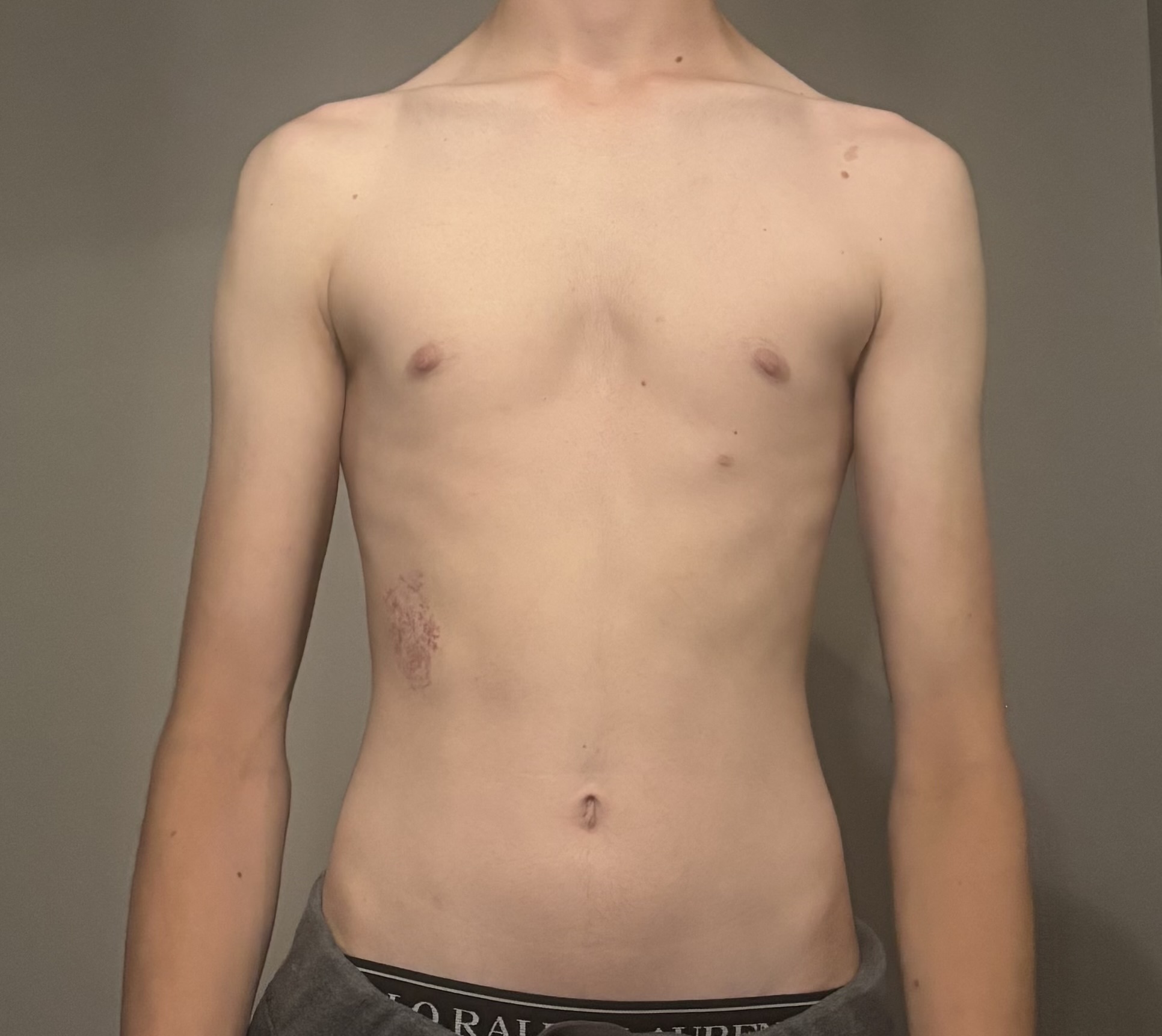 IMG 0938