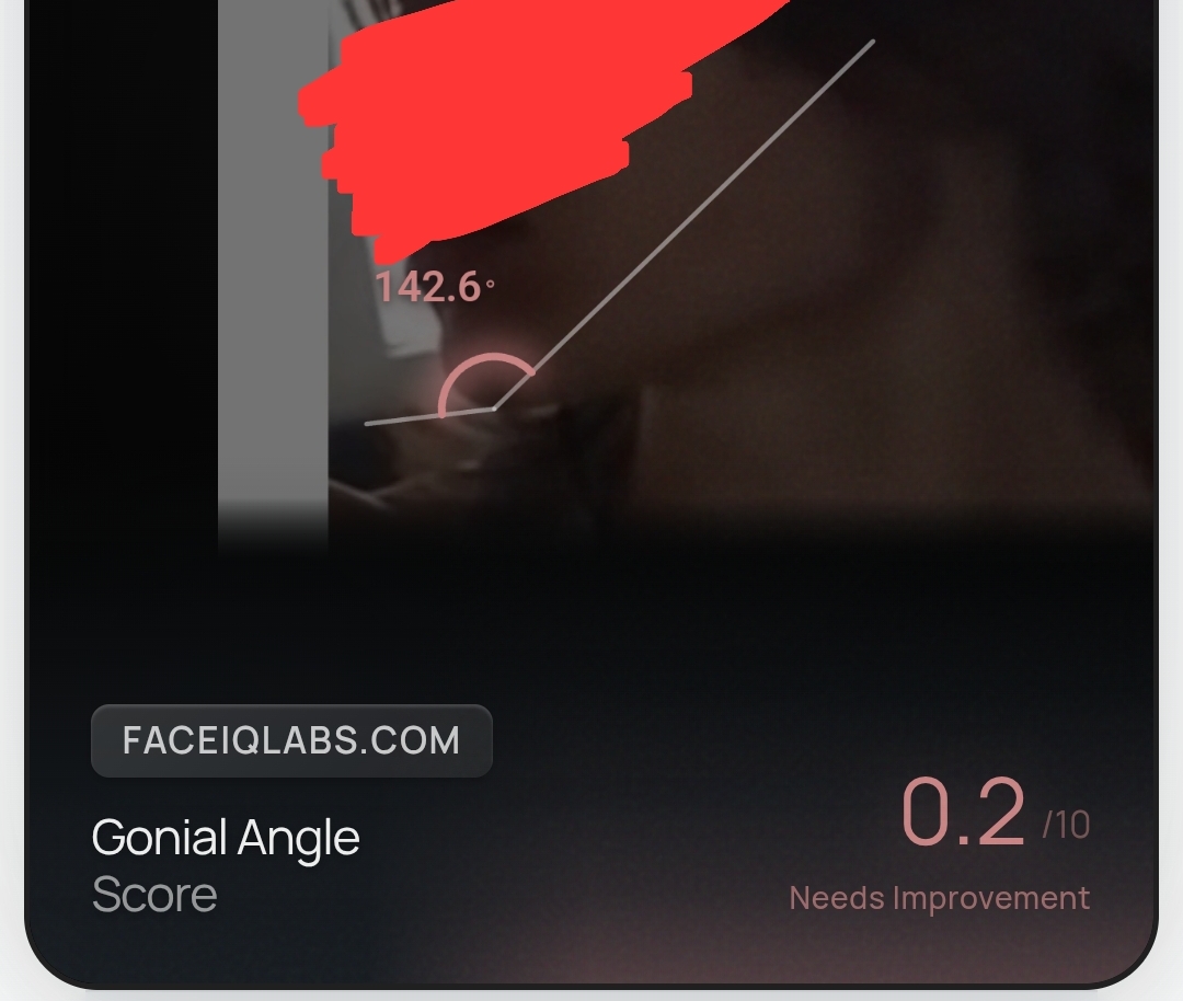 1000029581