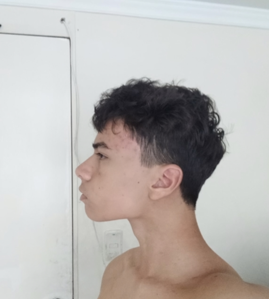 IMG 0254
