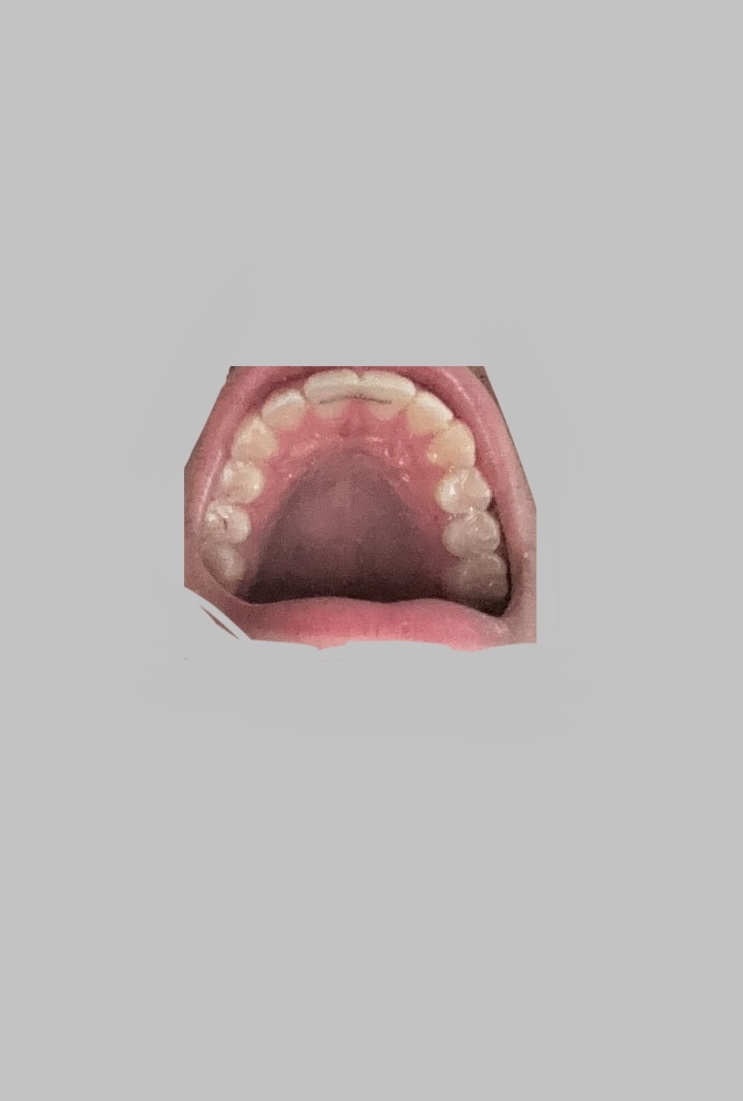IMG BE8CEADC B980 4F74 8F6F E653636CA12A