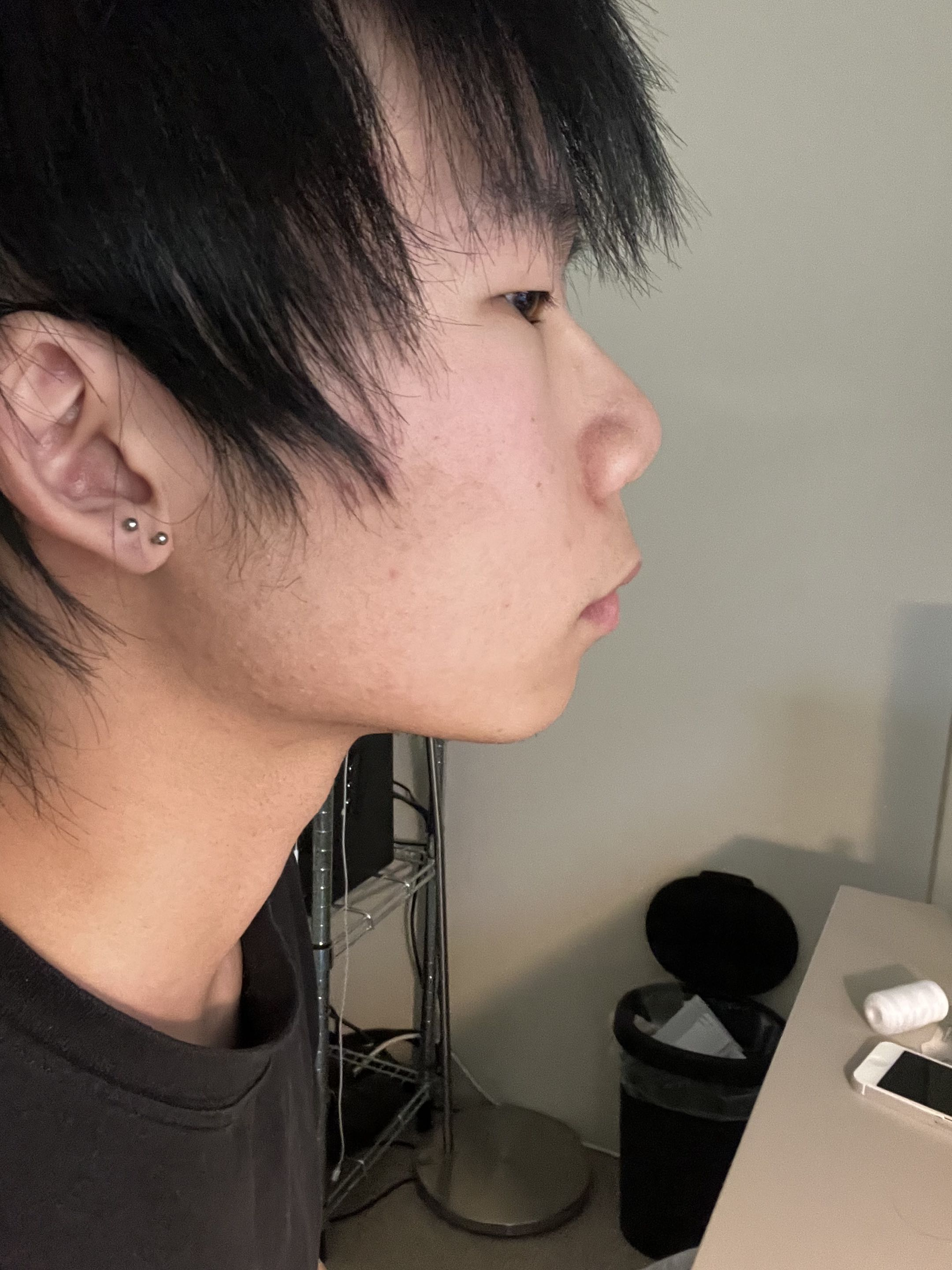 Side
