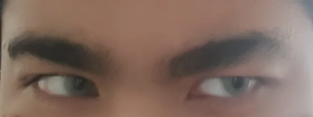1000093371