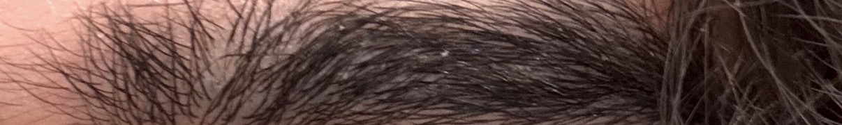 IMG 3911