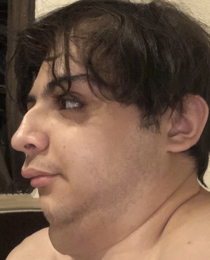 IMG 2973