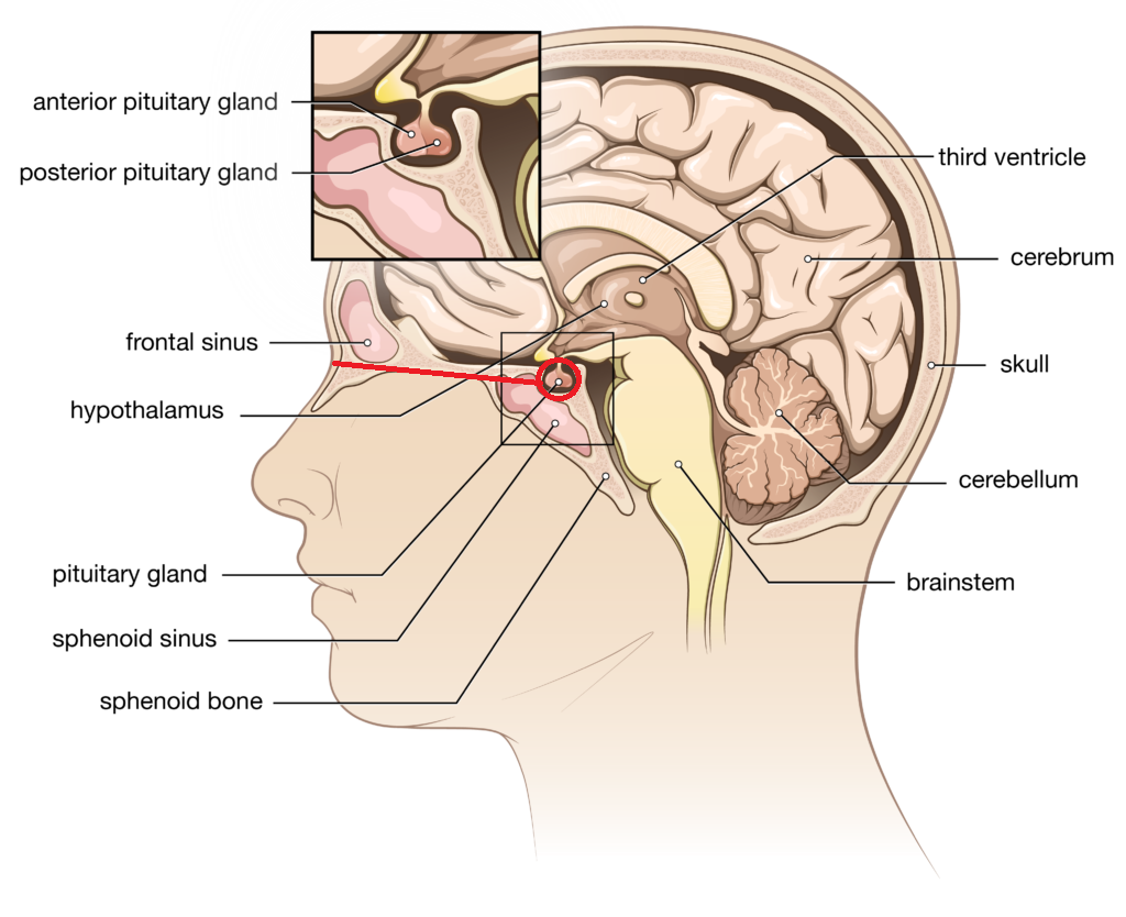 PituitarySurgery 01 1024x834