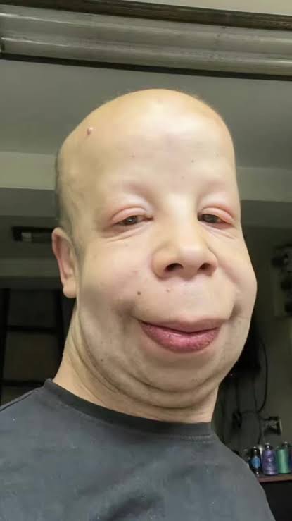 1000028260