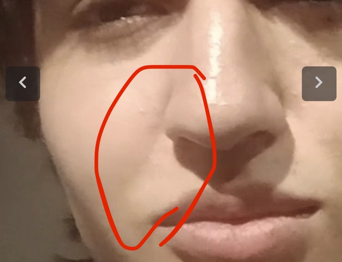 IMG 2661