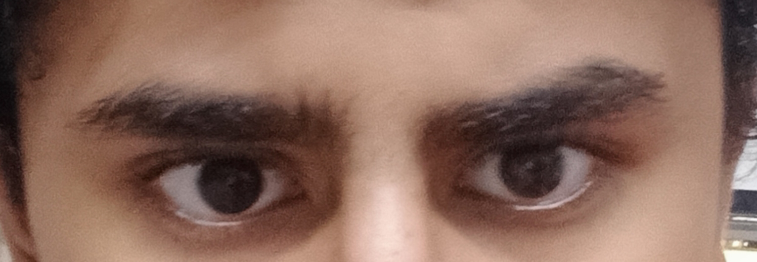 1000026623