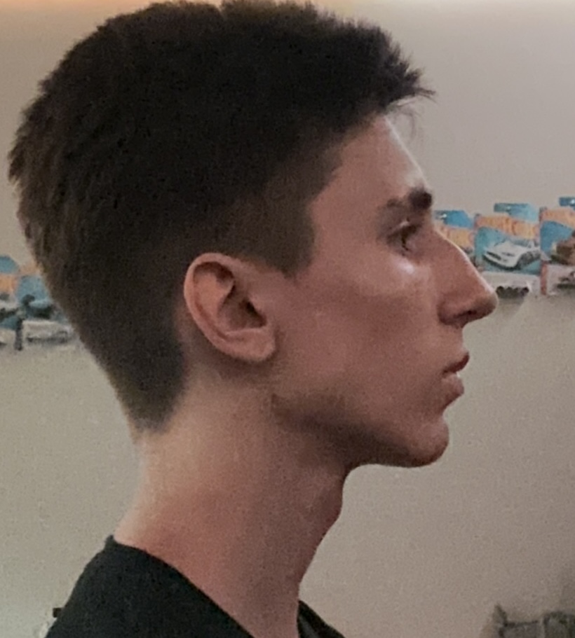 IMG 0299