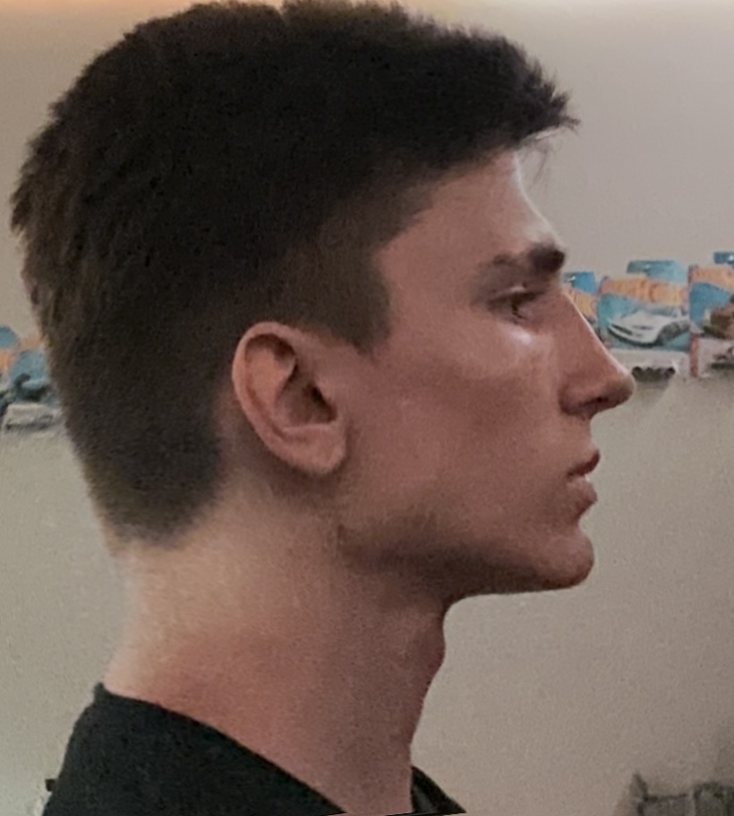 IMG 3392