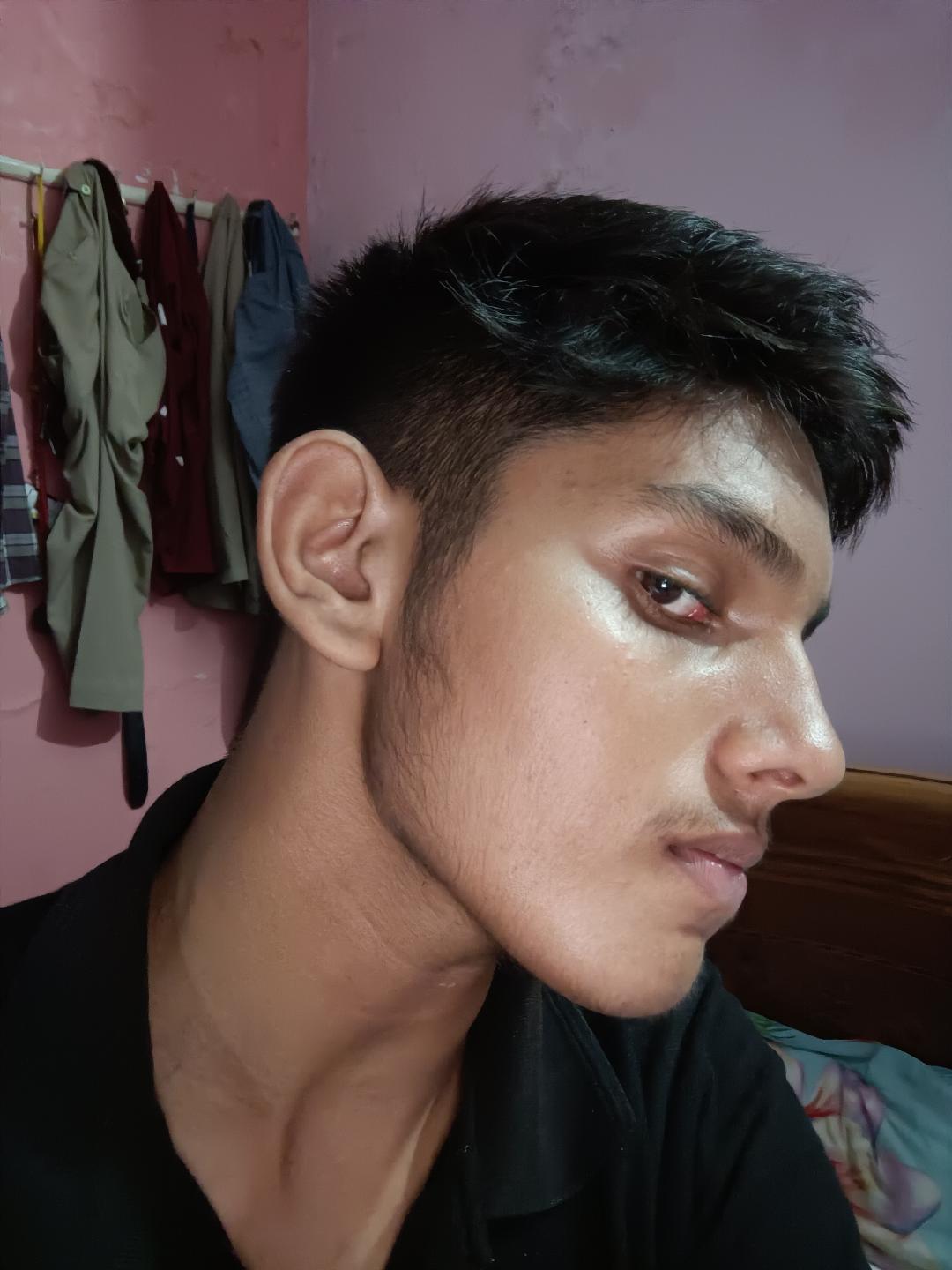 1000093416