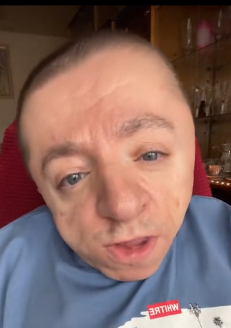 1000030379