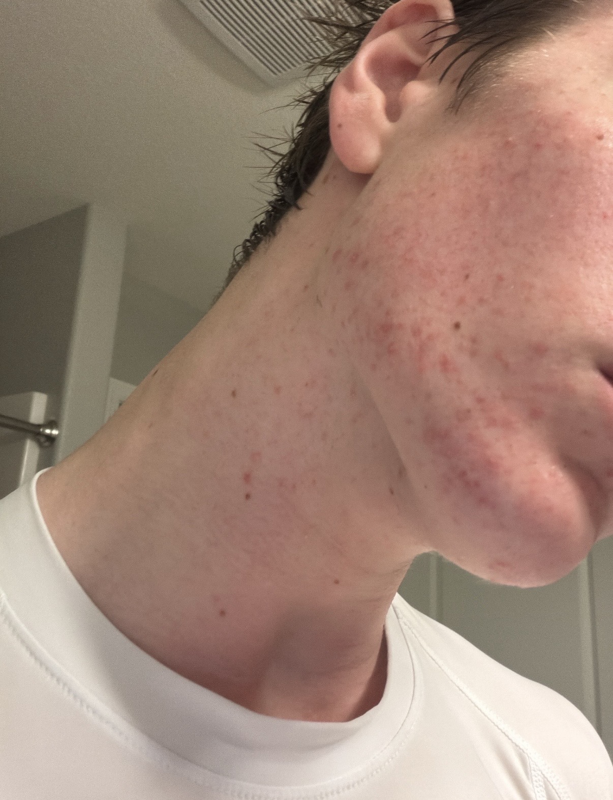 IMG 2677
