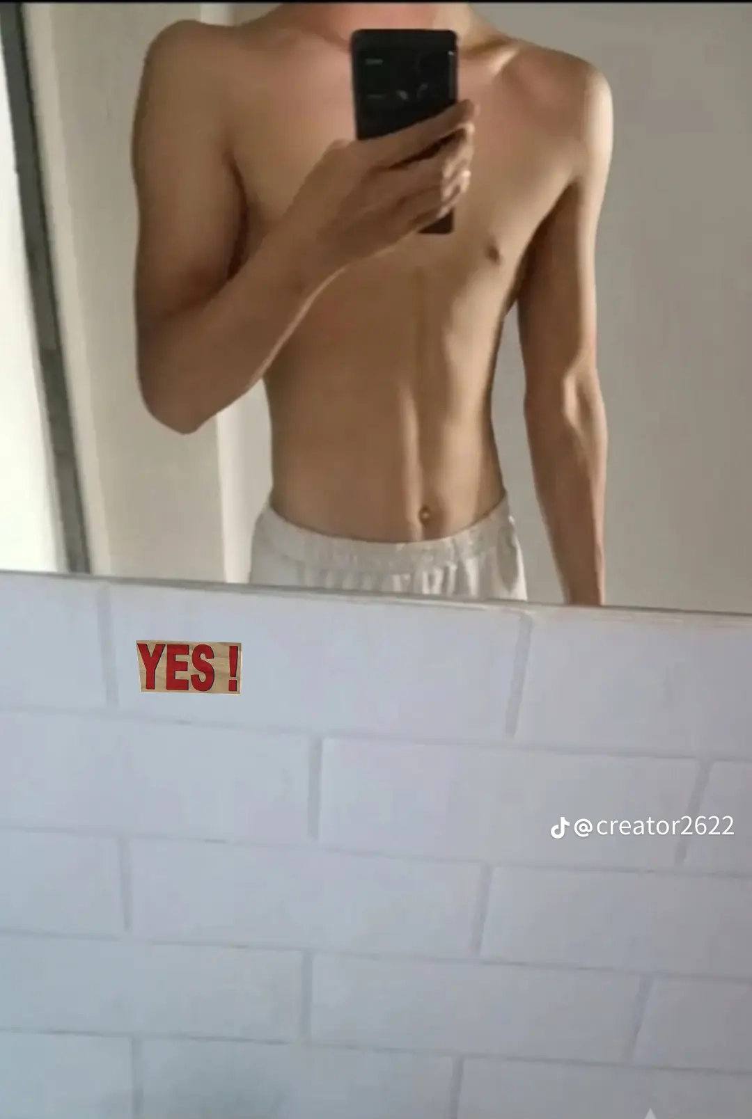1000145701