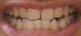 1787940176989