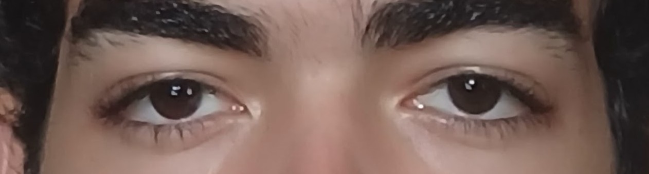 1000383386