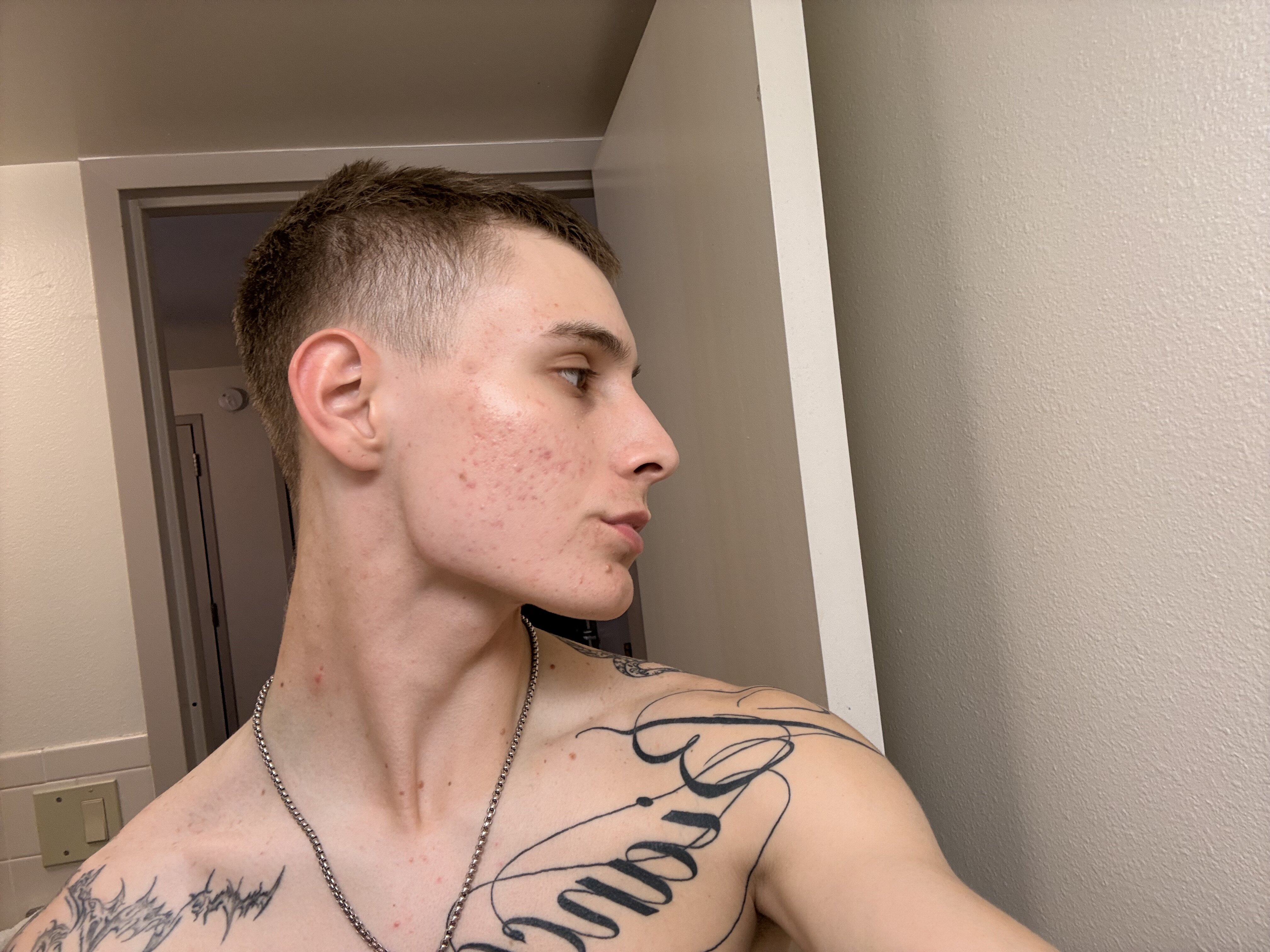 IMG 0977