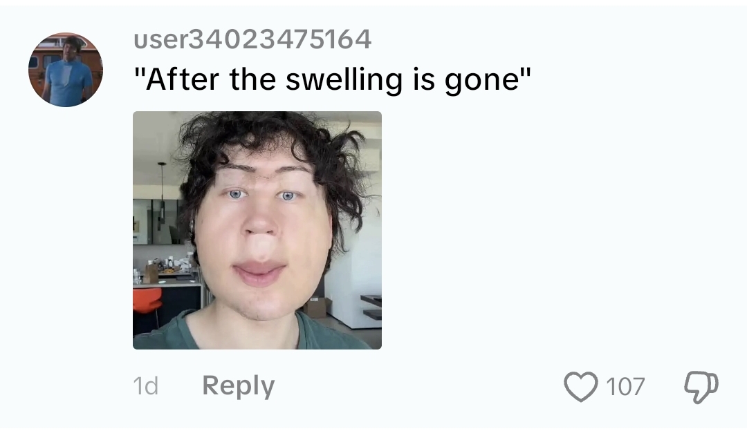1000105655