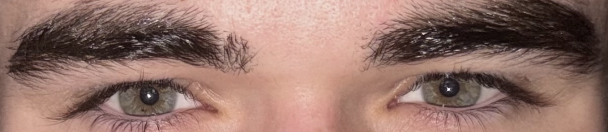 Eyes