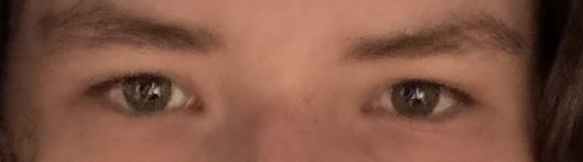 Eyes