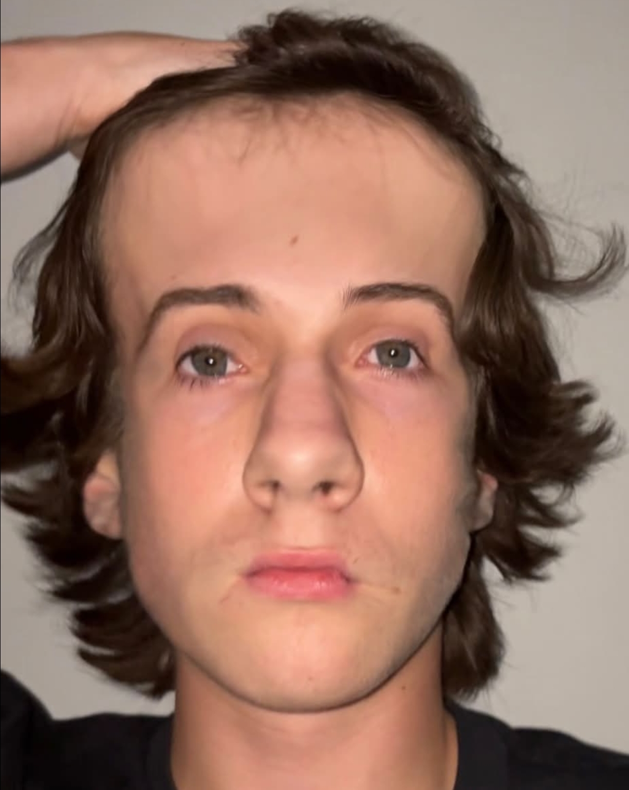 1000014278