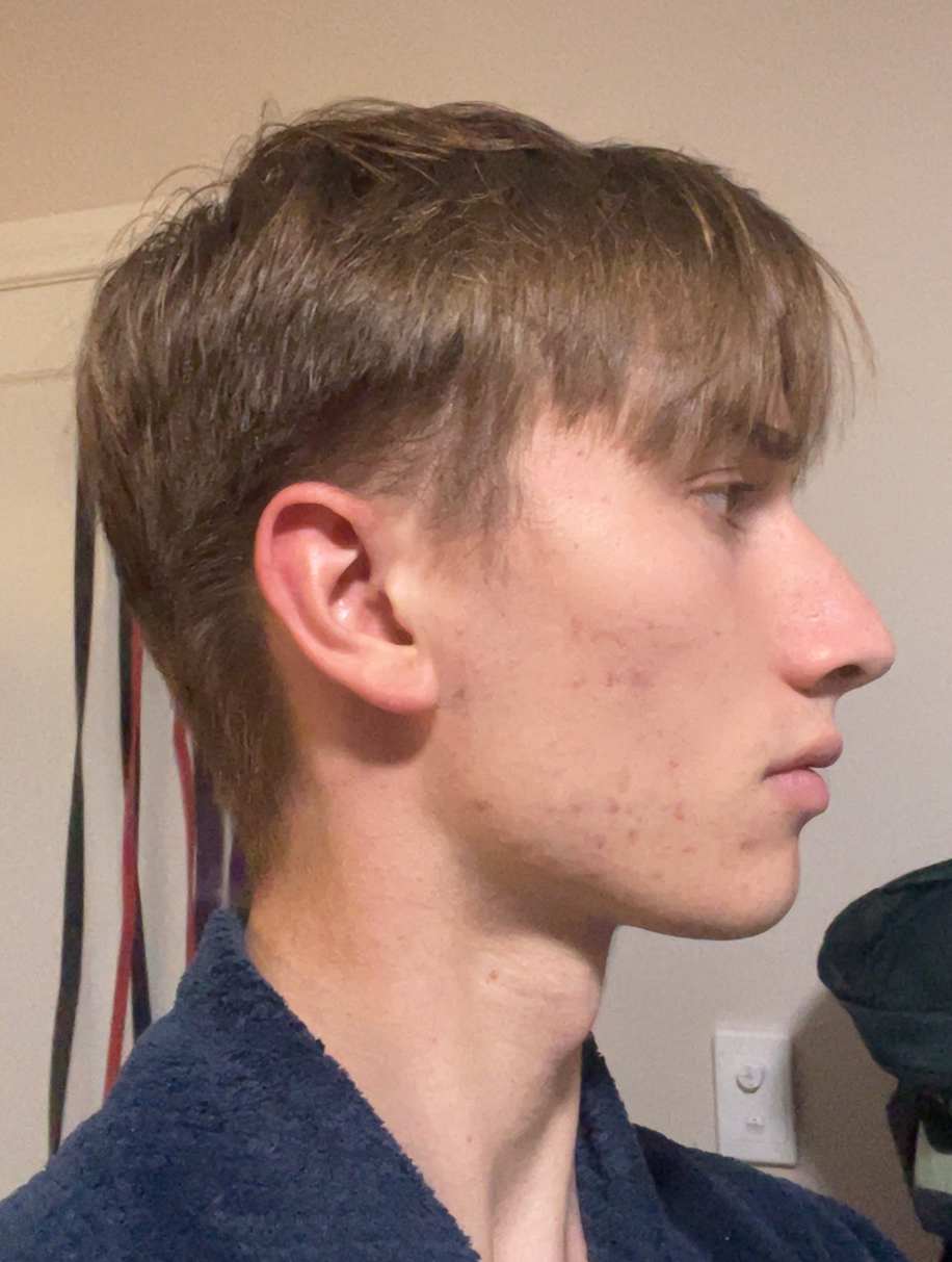 IMG 3055