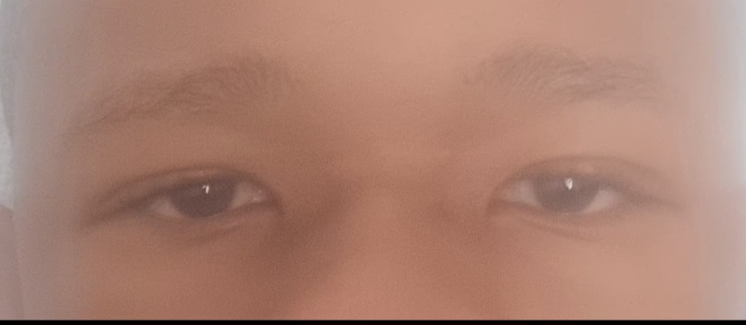 1000328924