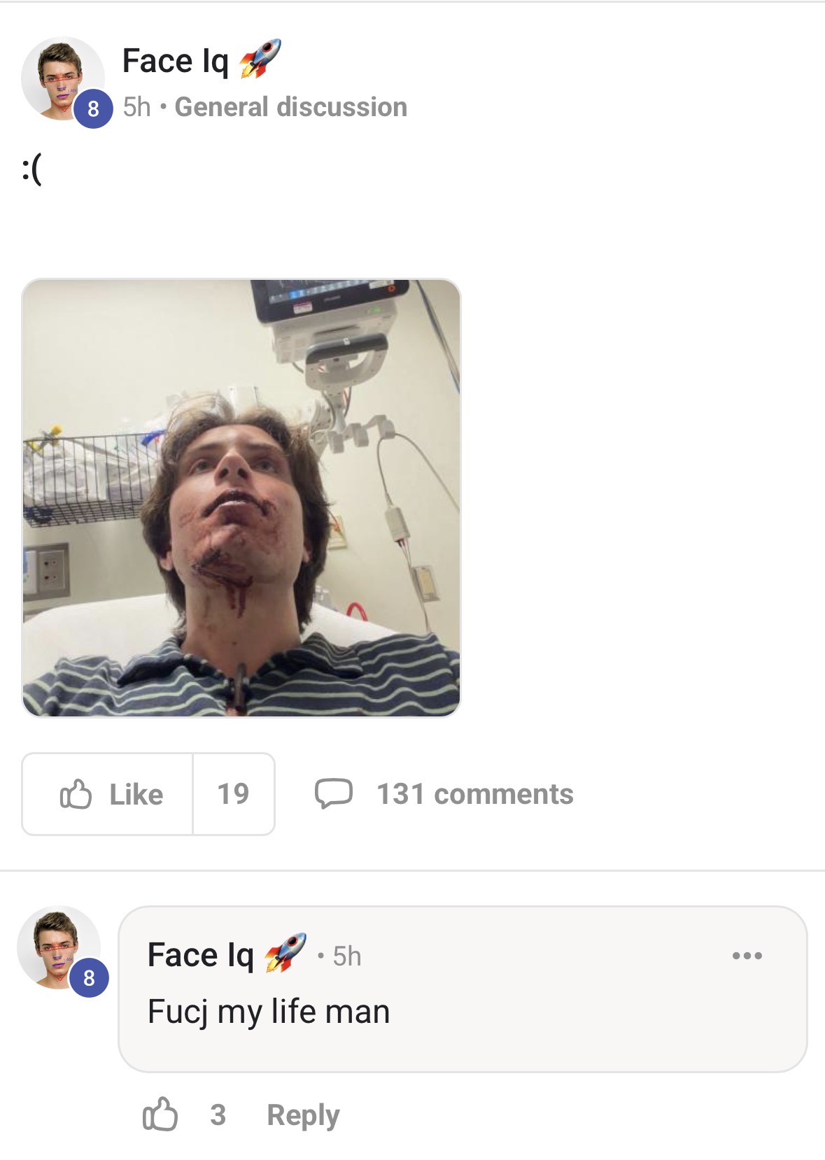 J