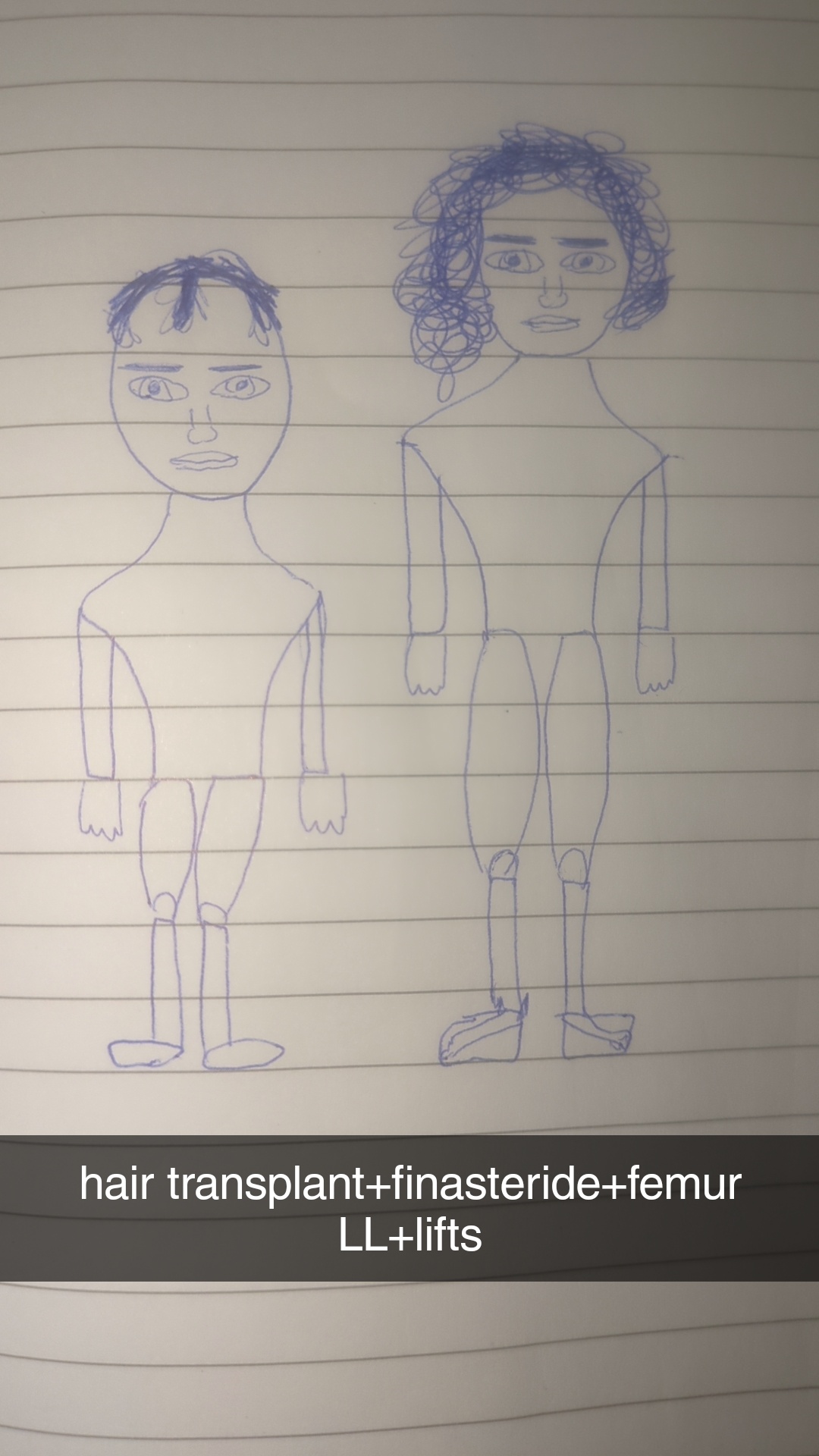 Snapchat 305702018