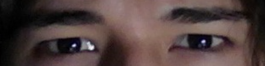 Eye Area Need Rating1