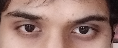 1000052442