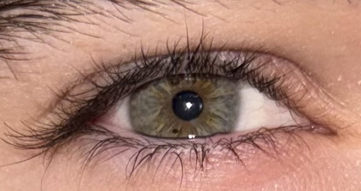 Right eye