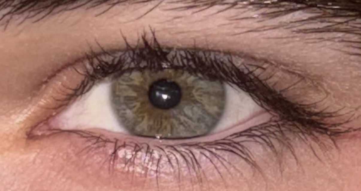 Left eye