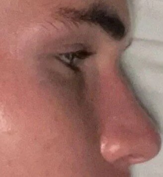 side.jpg
