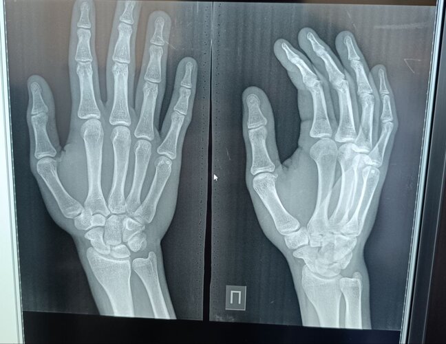 hand x-ray.jpg