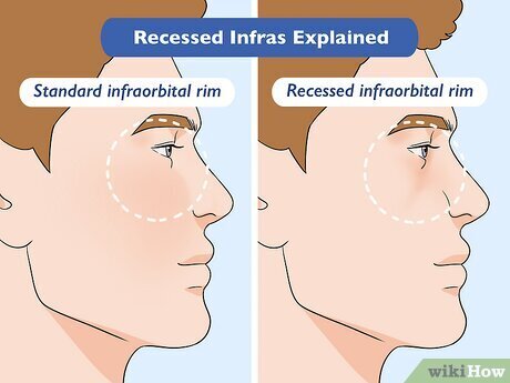 v4-460px-Recessed-Infras-Summary-Version-2.jpg