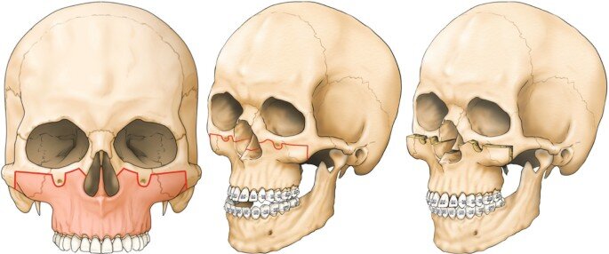 480405_1_En_5_Fig10_HTML.jpg