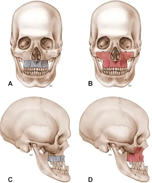 gr1-428.webp