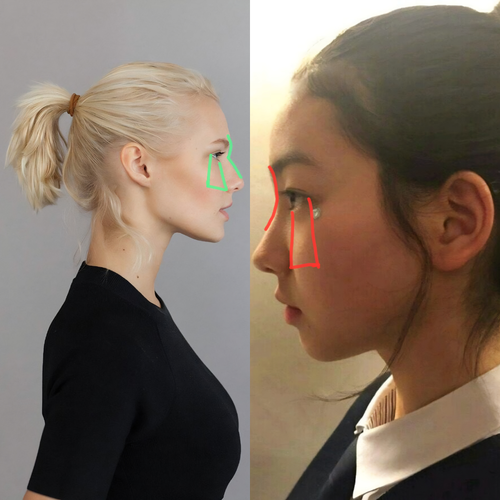 Lv 0 20260812001107
